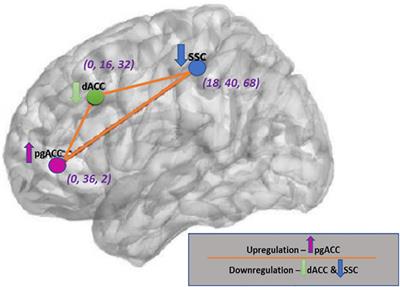 Source localized infraslow neurofeedback training in people with chronic painful knee osteoarthritis: A randomized, double-blind, sham-controlled feasibility clinical trial